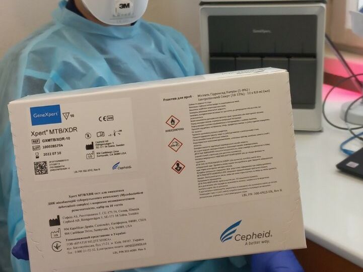 В Україні запроваджують інноваційну методику виявлення туберкульозу. Вона прискорює процедуру в 500 разів