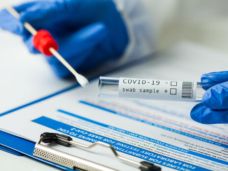 Інкубаційний період 