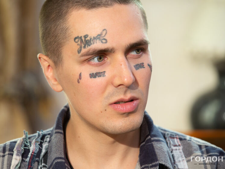 Рэпер Face свел татуировки с лица