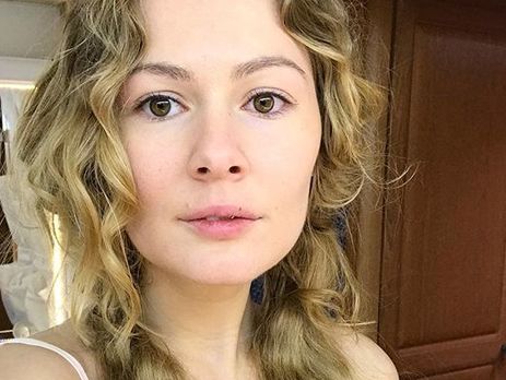 Кожевникова показала огромную гематому на руке