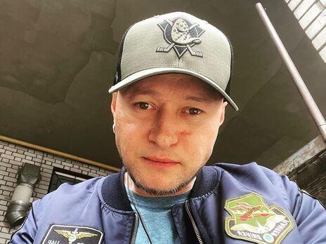 Хлывнюк: Я изъездил Россию вдоль и поперек. Теперь испытываю к россиянам презрение и брезгливость