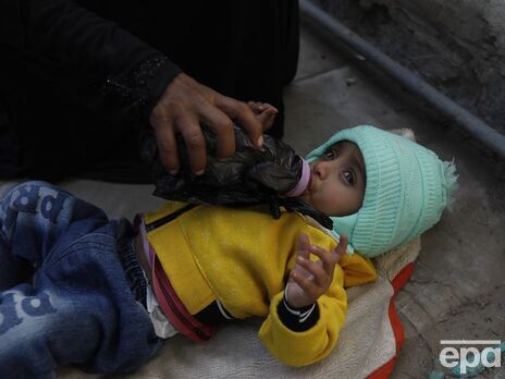 Более 30 млн детей в 15 странах страдают от истощения – ООН