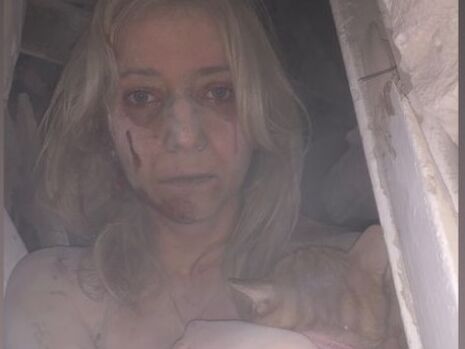 "Мені дуже пощастило". У Запоріжжі врятували дівчину, яка провела під завалами зруйнованого Росією будинку п'ять годин