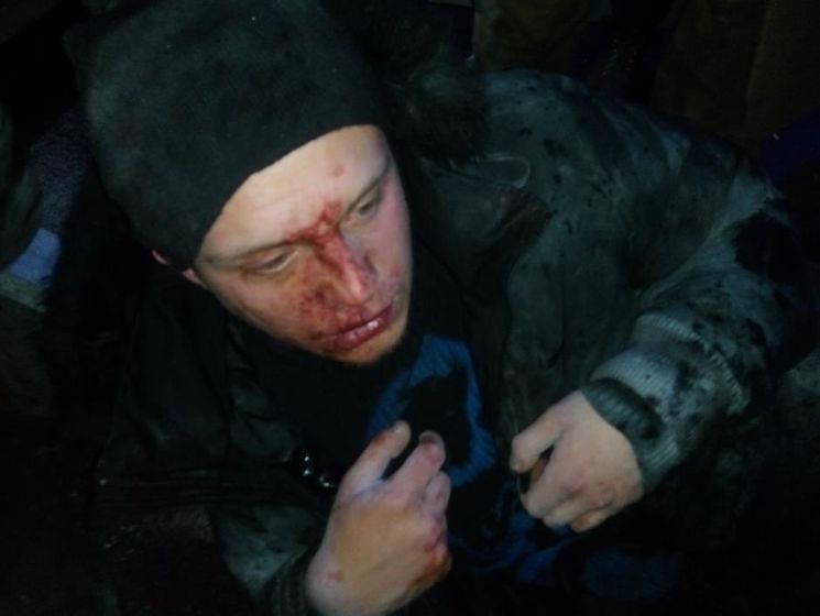 Семенченко: 40 титушек, калечивших утром людей на Харьковском радиорынке Киева, сданы в полицию