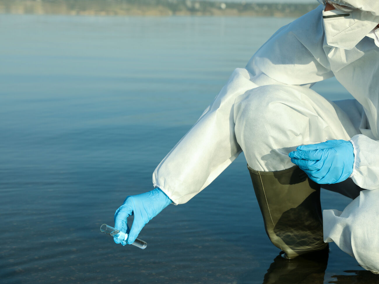 Вода будет заражена холерой. Вода будет заражена холерой. Холерный вибрион пути передачи. Вода будет заражена холерой. Вода будет заражена холерой.