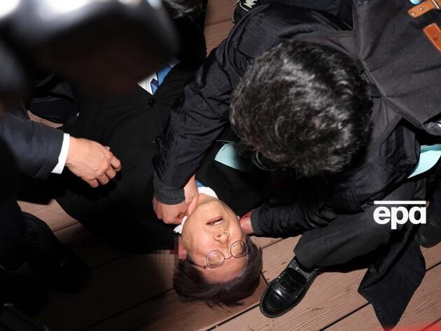 В Южной Корее мужчина с ножом напал на лидера оппозиционной партии