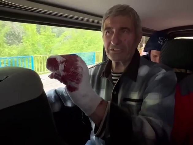 На околицях Вовчанська окупанти зайшли в будинок і відстрелили палець 74-річному жителю – прокуратура