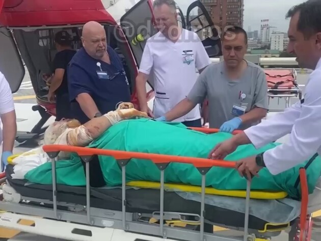 Весь в бинтах, лицо в ожогах. В РФ показали 