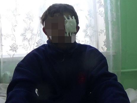 Захоплений під Авдіївкою бойовик підтвердив присутність на Донбасі російських військових – СБУ