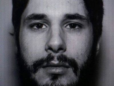 Медики спасли зрение раненному в Авдеевке британскому фотографу