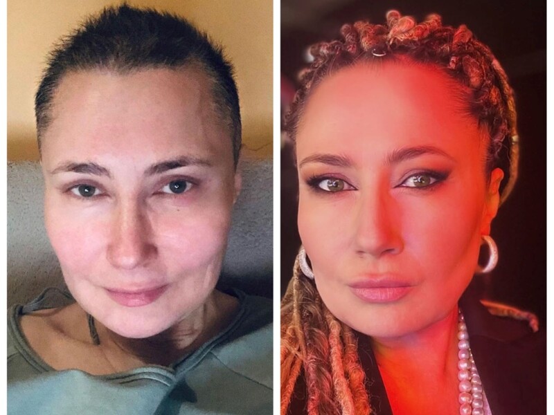 От стрижки под ноль до дредов. Как менялся имидж Мозговой. Фото