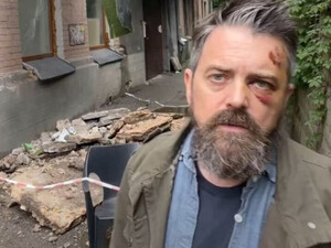 На режиссера из США, снимавшего фильм о войне, в Киеве упал балкон