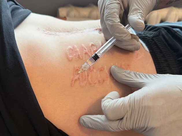 Врач объяснил, кто и как сделал украинскому защитнику шрам 