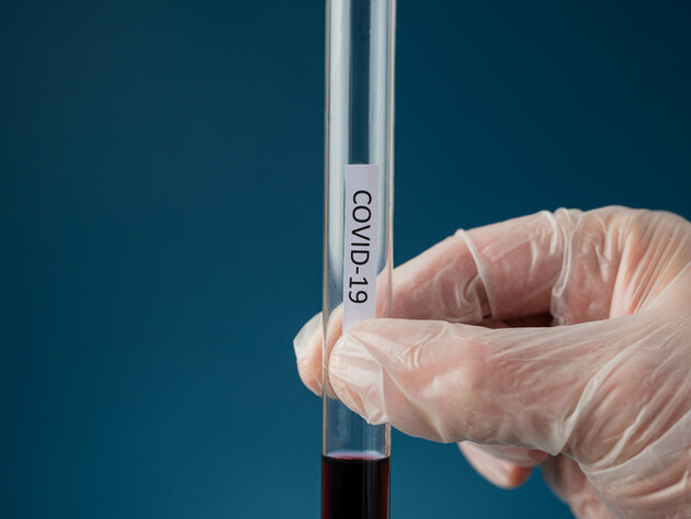 Новий штам коронавірусу Stratus підтвердили в семи областях України й Києві