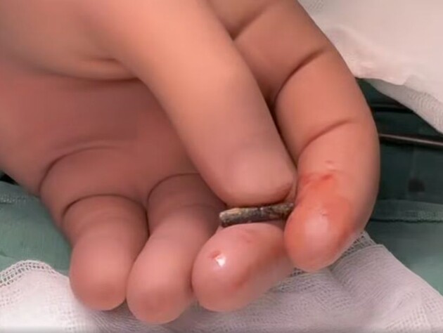 Український військовий три роки жив із кулею в серці. Що з ним сталося?