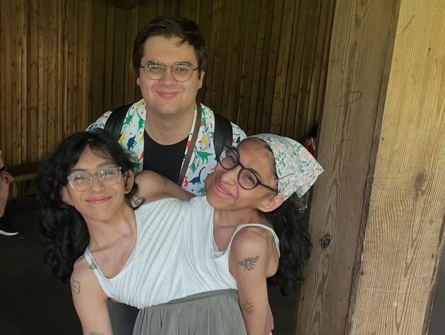 25-річні сіамські близнюки з Мексики відверто розповіли про інтимне життя заміжньої сестри