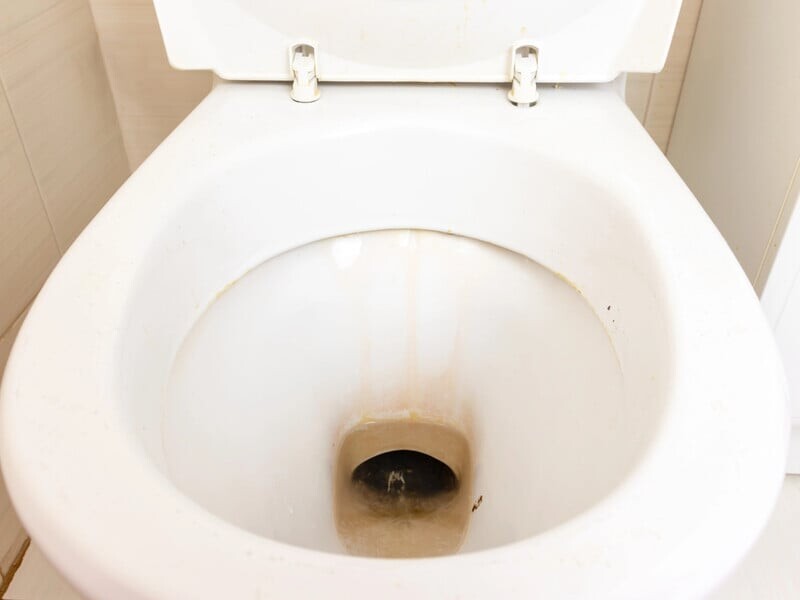 Просто засыпьте этим унитаз – и он станет совершенно чистым. Элементарный способ