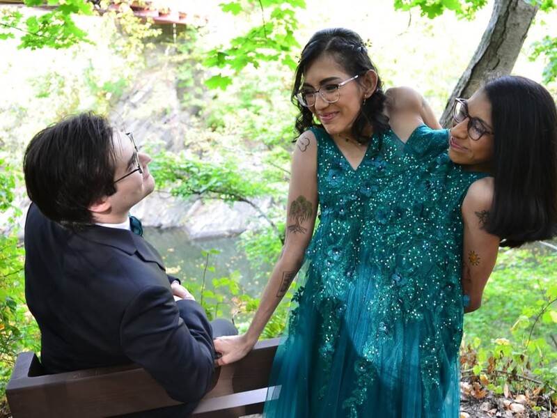 Одна из знаменитых сиамских близнецов Андраде в первую годовщину брака показала новые фото с мужем