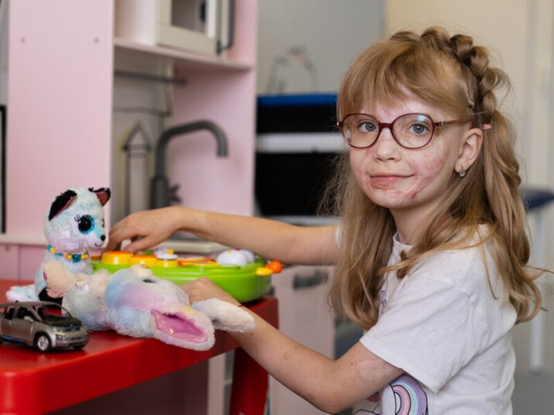 "Ожоги были повсюду". Девочка, пострадавшая в катастрофе вертолета в Броварах, вернулась из США