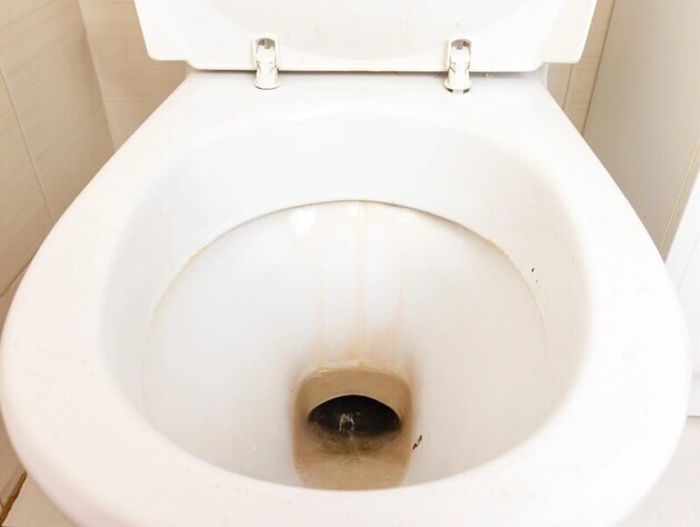 Цей копійчаний розчин вичистить унітаз до блиску! Просто залийте на кілька годин