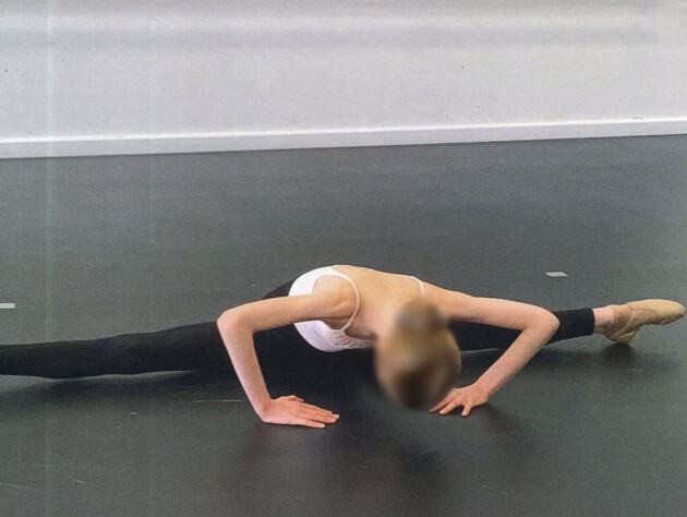 Заможні батьки морили голодом доньку-балерину. Викладачі балету врятували дівчину від смерті