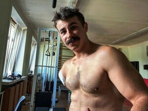 Ярослав Грубич: Це не в реанімації мені відрізали руку – вона була вирвана уламком російського снаряда