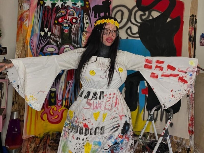 33-летняя модель, которая после взрыва импланта осталась с одной грудью, найдена мертвой на парковке