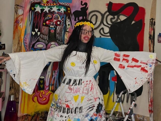 33-летняя модель, которая после взрыва импланта осталась с одной грудью, найдена мертвой на парковке