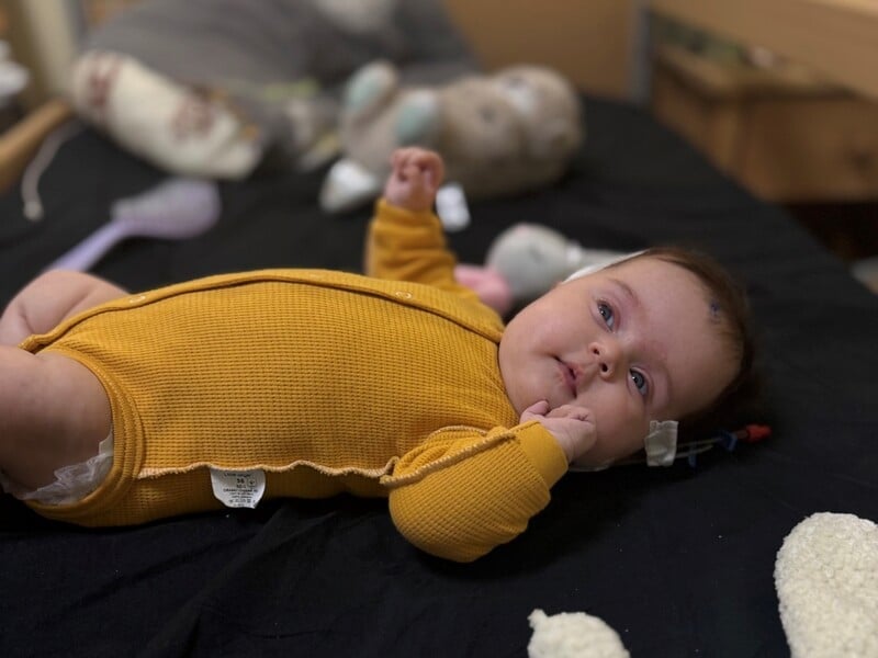 У Львові провели унікальну операцію й урятували немовля з пухлиною мозку