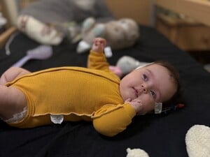 У Львові провели унікальну операцію й урятували немовля з пухлиною мозку