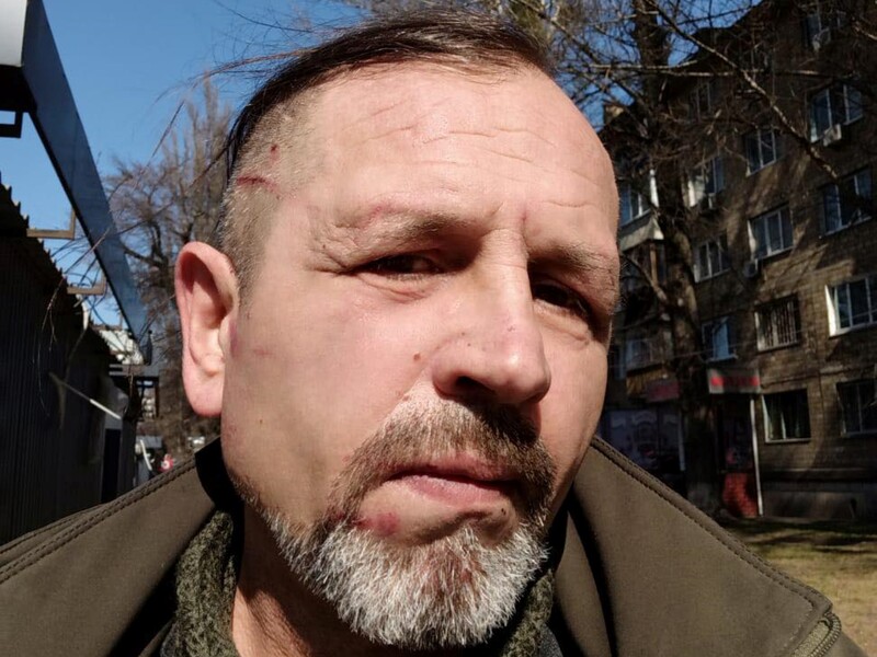 Побиття експолітв'язня з інвалідністю в ТЦК у Києві, поліція почала перевірку. Що відповіли у військкоматі?