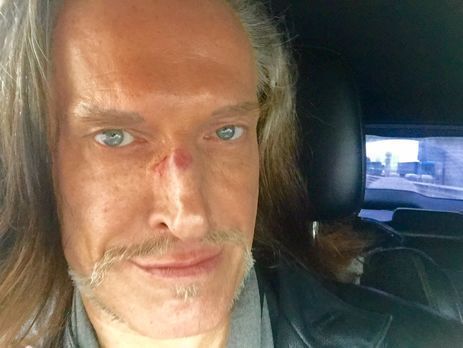 Джигурда о причинах лишения его 