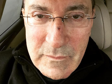 Буйнов страждає від пошкодження меніска