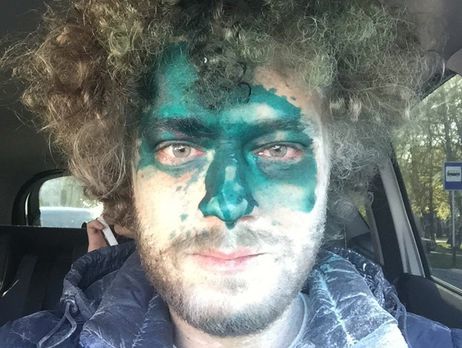 Трех напавших на Варламова оштрафовали на 500 рублей, еще двоих отправили под админарест