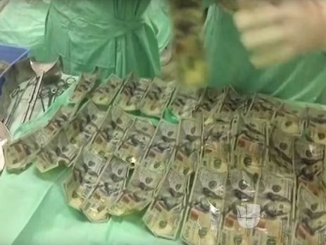 Жительница Колумбии проглотила назло бойфренду около $9 тыс.