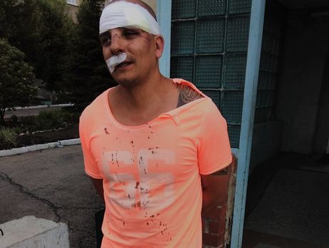 В Иркутске неизвестные избили сына владельца помещения, где расположен штаб Навального – координатор штаба