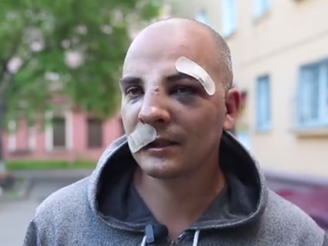 Сын избитого иркутского бизнесмена о сдаче в аренду помещения штабу Навального: Отказать арендатору – признать свою слабость