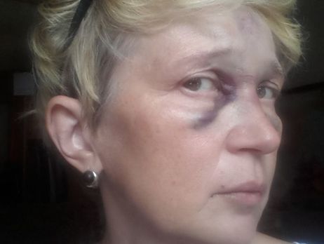 В Одессе избили известную журналистку
