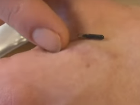 Компания в США предложила сотрудникам вживить микрочипы