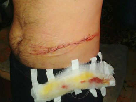 Во время этапирования из Одессы в Запорожье заключенный разрезал себе горло и живот