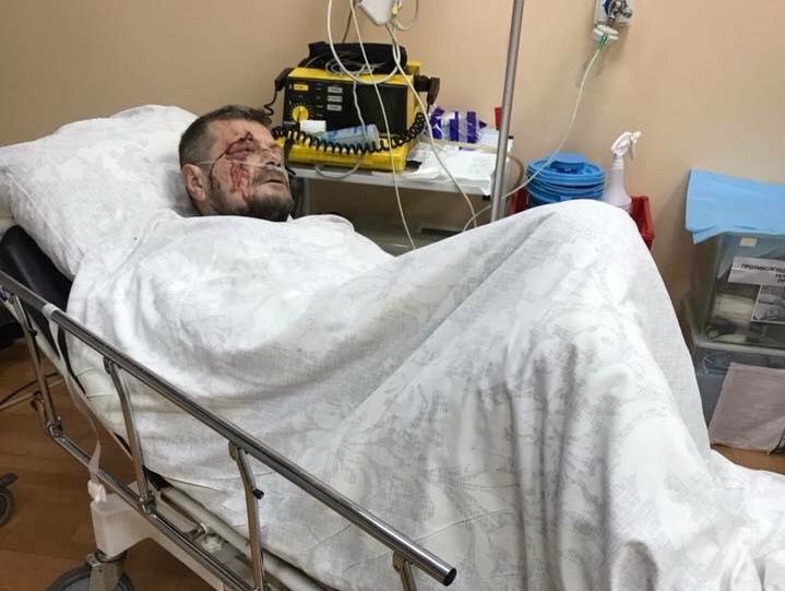Президент клиники "Борис" Радуцкий: У Мосийчука много осколочных ранений конечностей и спины, его еще оперируют