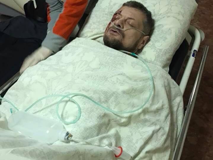 ﻿Лікар повідомив, що стан Мосійчука важкий, найбільше постраждали кінцівки і м'які тканини