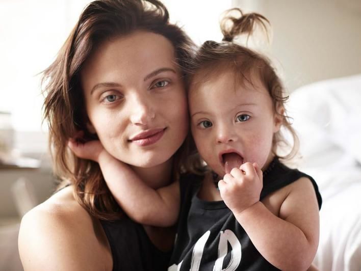 На обложке Vogue Living разместили фото ребенка с синдромом Дауна