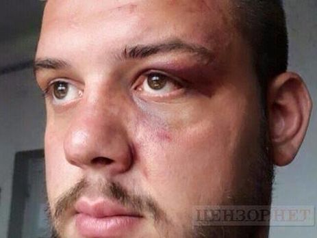 Прокуратура передала до суду обвинувальний акт стосовно екс-торнадівця, який забив до смерті арештанта СІЗО