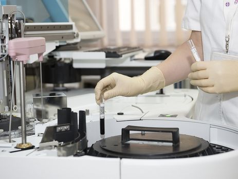 МОЗ: В Україні немає епідемії гепатиту А