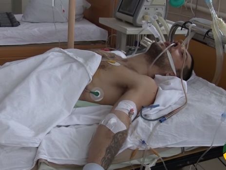 Украинские военные рассказали о задержании российского диверсанта, получившего в бою ранение в пах. Видео