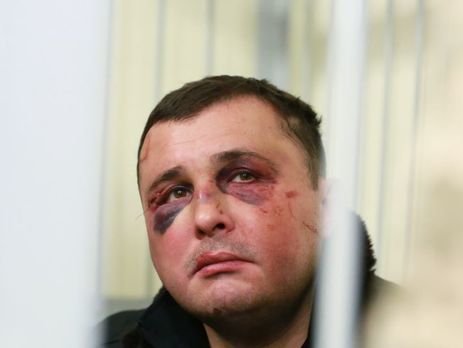 Апелляционный суд оставил под стражей экс-нардепа Шепелева
