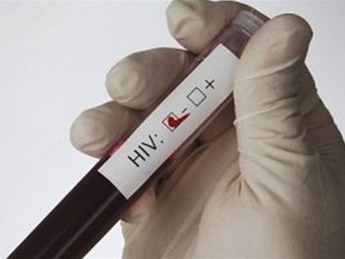 В столице организована акция по проведению тестов на ВИЧ-инфекцию
