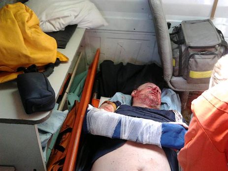 В Кременчуге избили члена 