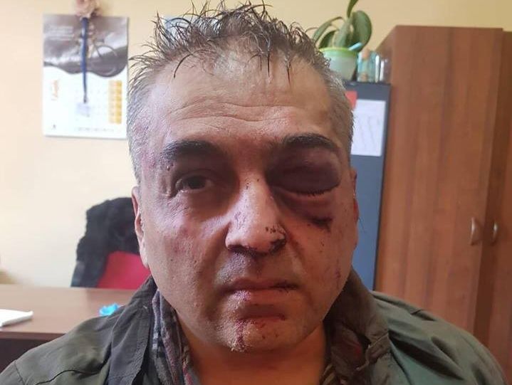 В Ереване высокопоставленный полицейский ограбил банк, один человек погиб